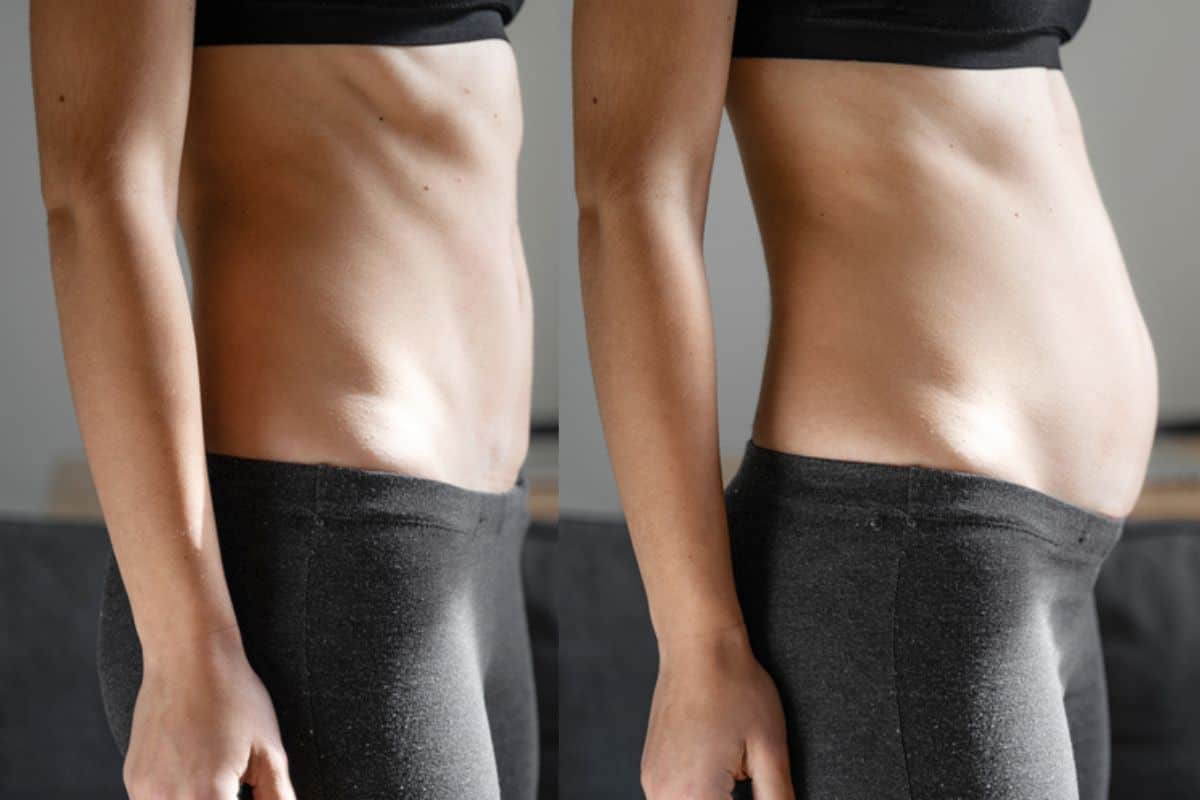 How long does diastasis recti take to improve Huntingdon?