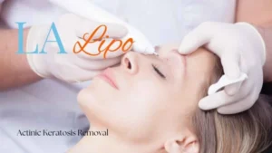Woman receiving Actinic Keratosis Removal Treatment Huntingdon