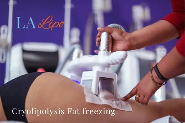 women getting fat freezing Huntingdon