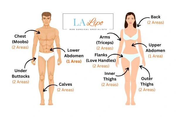 LA LIPO Cryolipolysis Areas Huntingdon